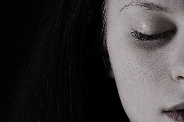 Dark circles